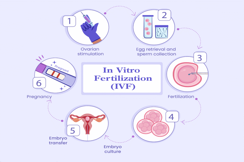 IVF